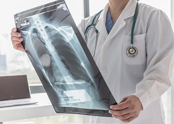 A doctor in a white coat holds a chest X-ray in front of a window overlooking a city. He wears a stethoscope around his neck.