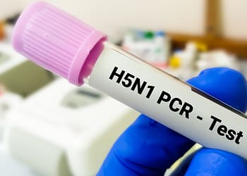 Un tubo de ensayo en una mano con una tapa morada, etiquetado como "H5N1 PCR - Test", en un entorno de laboratorio.