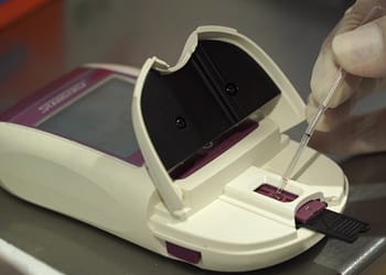 A medical monitoring device with an open lid, in which a gloved hand inserts a pipette into the front of the device.