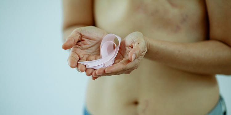 Una persona sin camiseta sostiene un lazo rosa en ambas manos, mostrando cicatrices en su torso.