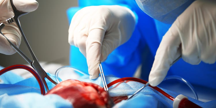 A surgeon wearing gloves and a mask is performing an operation on an exposed heart, using surgical instruments.
