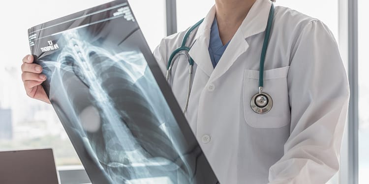 A doctor in a white coat holds a chest X-ray in front of a window overlooking a city. He wears a stethoscope around his neck.