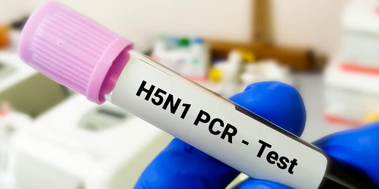 Un tubo de ensayo en una mano con una tapa morada, etiquetado como "H5N1 PCR - Test", en un entorno de laboratorio.
