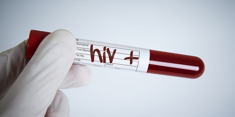 Un tubo de ensayo con una tapa roja, sosteniéndolo con una mano enguantada, que tiene una etiqueta donde se escribe "hiv +".